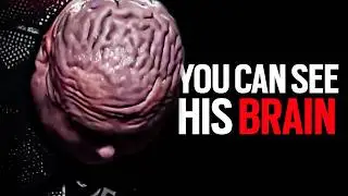 Growth Hormone Is Mutating People