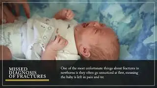 What Happens When Your Baby Is Born With a Broken Bone?
