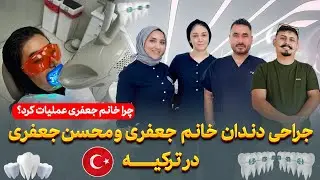 لمینت دندان خانم جعفری در استانبول،کلینیک دندان افغان ها در ترکیه با مجهزترین دستگاه ها 