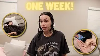 One Week Post-Op BBL Surgery UPDATE! *recovery*