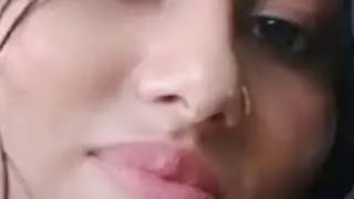 AMPUTEE vlog लाइव है!