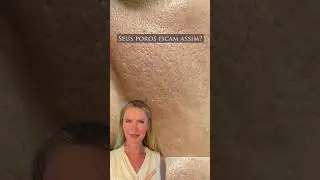 Voc&ecirc; sofre com poros dilatados? #shorts  #skincare #beleza #skincareroutine