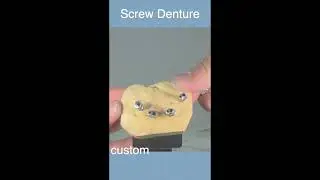 Kage signature-  screw Denture! #allonx  #denture #틀니 #shorts