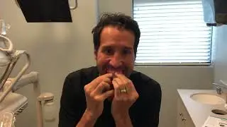 Easydenture Fitting