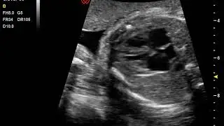 Fetal Heart by Clover60