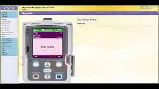 CADD-Solis V4 Pump Training: START & STOP PUMP [Part 7/15]
