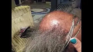 Balding caused by Meds/Crochet Latch hook HELPS!
