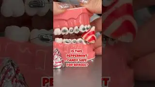 IS CHEWING GUM SAFE FOR BRACES? 🦷👀 #shorts