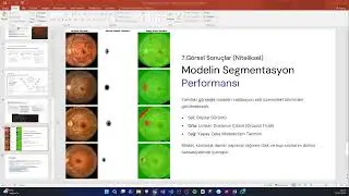 Attention U-Net Mimarisi İle Optik Disk Ve Optik Kupa Segmentasyonu Glokom Teşhisi