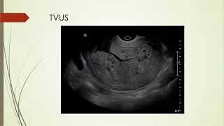 Brown Ultrasound Case of the Month April 2018