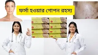 5 দিনে ফর্সা | মাই ফেয়ার | মাই ফেয়ার ক্রিম | মাই ফেয়ার ক্রিম ব্যবহারের নিয়ম | myfair cream