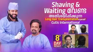 Shaving & Waiting വേണ്ട അതിശയിപ്പിക്കുന്ന Long Hair Transplantation Cutis International!