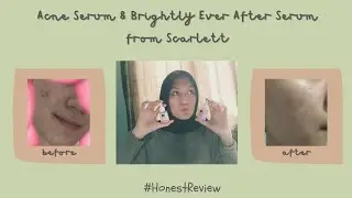 ACNE SERUM & BRIGHTLY EVER AFTER SERUM REVIEW FROM SCARLETT // SERUM TERBAIK 2021 😭♥ | ranisaputraa