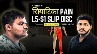 Sciatica Pain Chiropractic Treatment | Arsh Spine Care | Patient Review #arshspinecare #chiropractic