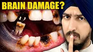 Missing Teeth = Brain Damage? New Study Reveals