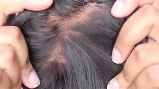 Silk Closure vs Lace Closure by Ambre Renee