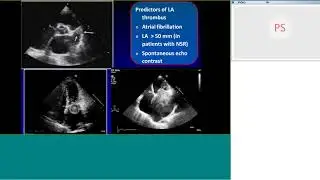 Pedicardio classes on Rheumatic heart disease echo, prevention by Dr Anita Saxena
