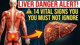 7 Warning Signs Your Liver is Full of Toxins (Fatty Liver Symptoms You Ignore)