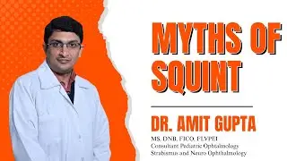 MYTHS of Squint | भेंगापन से जुड़ी गलतफहमियां | Sood Hospitals