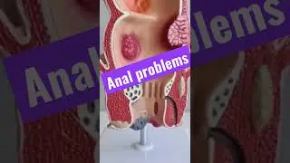 Anal Pain and Anal Problems I SURAT I MUMBAI I INDORE I India