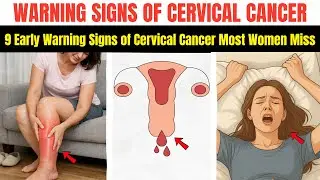 9 ранних признаков рака шейки матки, которые большинство женщин пропускают | Симптомы рака шейки ...