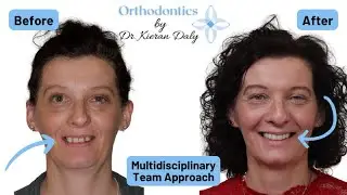 Multidisciplinary Team Approach