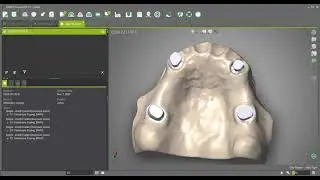 DWOS - Create a telescopic coping