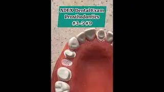 ADEX Dental Exam - Prosthodontics Crown Preps #adex #dental #exam #dentist