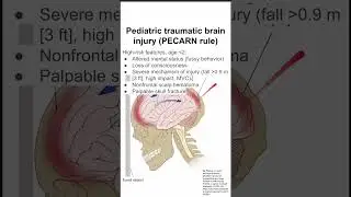 Pediatric traumatic brain injury (PECARN rule)