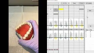 Perio - How to use the nabers probe