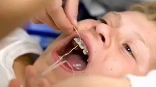 Glendale Cosmetic Dentist | Rent This Video Call 323-540-4543 in Glendale