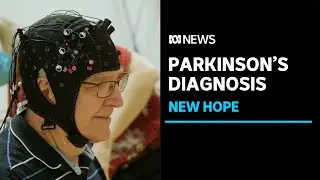 Movie technology can pick up neurological diseases, researchers say | ABC News