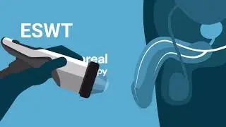 Shockwave Therapy For Erectile Dysfunction Animation Short @GulfCoastMD