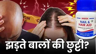 झड़ते बाल? Solution चाहिए? Bakson Hair & Nail Homeopathy से पाएँ जबरदस्त फर्क&ndash; Usage, Dosage, फ़ायदे
