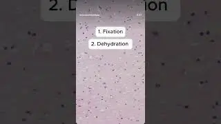 How Tissue Becomes Slide Ready 🧬 | Tissue Processing Full Process | #MedLabDisha
