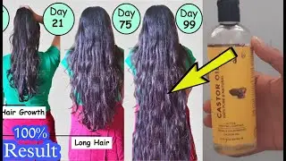 Castor oil for extreme hair growth|winter Hair Care Hacks|21Days Challenge,ForThickerLonger Hair