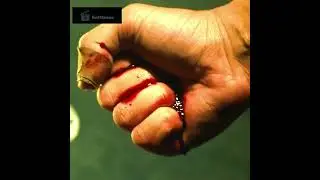 Whiplash