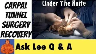 Getting Carpal Tunnel Surgery - Workout Recovery Tips