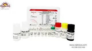 ATHENESE Dx HBsAg ELISA Kit