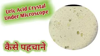 How to identify crystal | uric acid crystal | uric acid