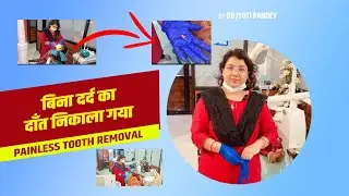 &ldquo;Tooth Extraction Without Pain&rdquo; | Painless Tooth Removal