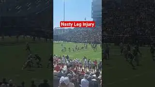 Purdue Boilmakers Football Freahman WR Jalil Hall Nasty Leg Injury #collegefootball #purdue #injury