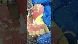 How to repair a cracked denture #dentist #satisfying #asmr