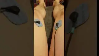 Avis Electrodes Perf Snaps