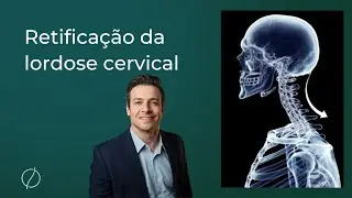 Retificação da lordose cervical