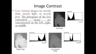 image processing | Lec 5 شرح