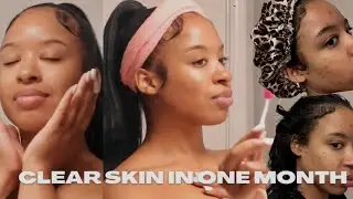 HOW I GOT CLEAR SKIN IN ONE MONTH 2022 + FADE HYPERPIGMENTATION + ROAD TO GLASS SKIN + NIGHT TIME
