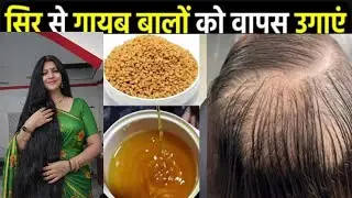 अब बाल बढ़ेंगे Bal lambe kese kre/Bal lambe karne ka tarika/Fast Hair Growth Serum for Extreme Hair 