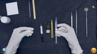 What is Indirect Pulp Capping? II MGMDCH