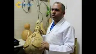 Kabak Avizeler